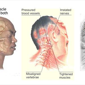 Headache Maine Migraine - Headache? Learn About Its Causes And Remedies