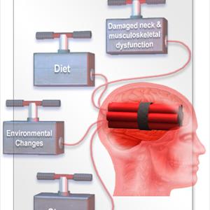 Migraine Clinical Studies - What Is The Chronic Headache Cause And Where To Find Treatment Information